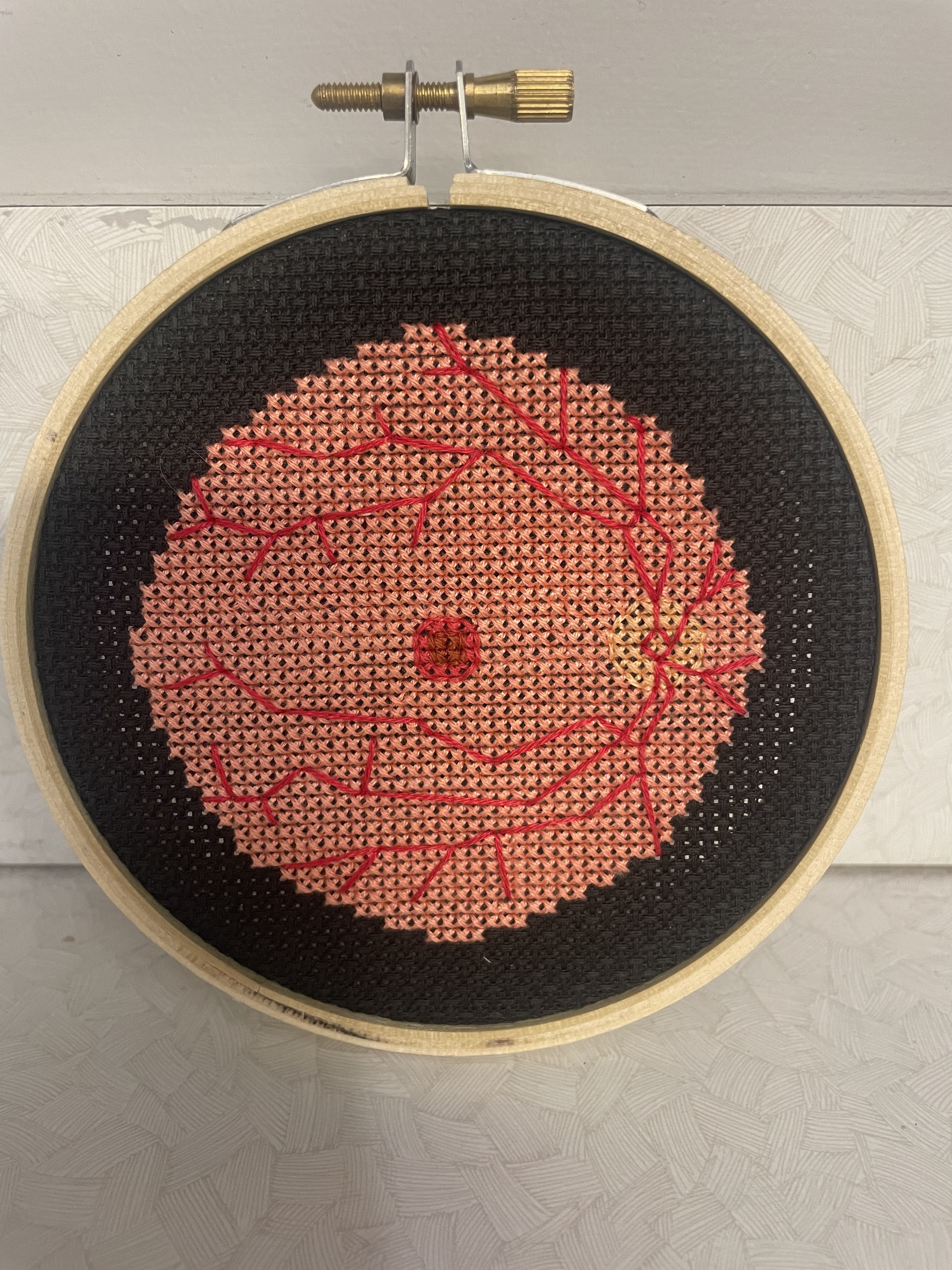 Retina Scan (Fundus)